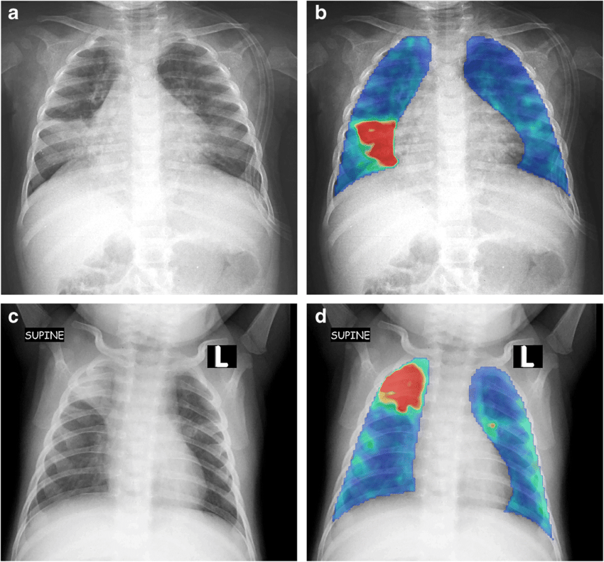 Medical-Heatmap